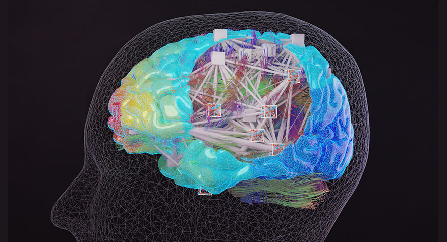 Illustration einer elektronischen Gehirnstimulation